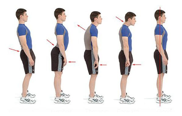 Osteochondrose prevention