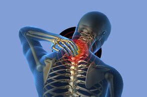 Symptoms of cervical osteochondrose