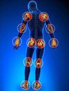 Localization of joints affected by arthrosis