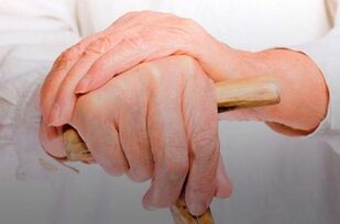 pain in the finger joints in rheumatoid arthritis