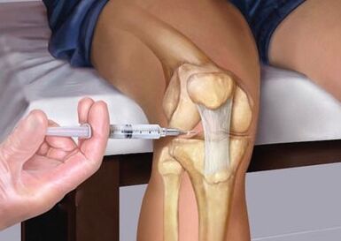 Injecting in wrist